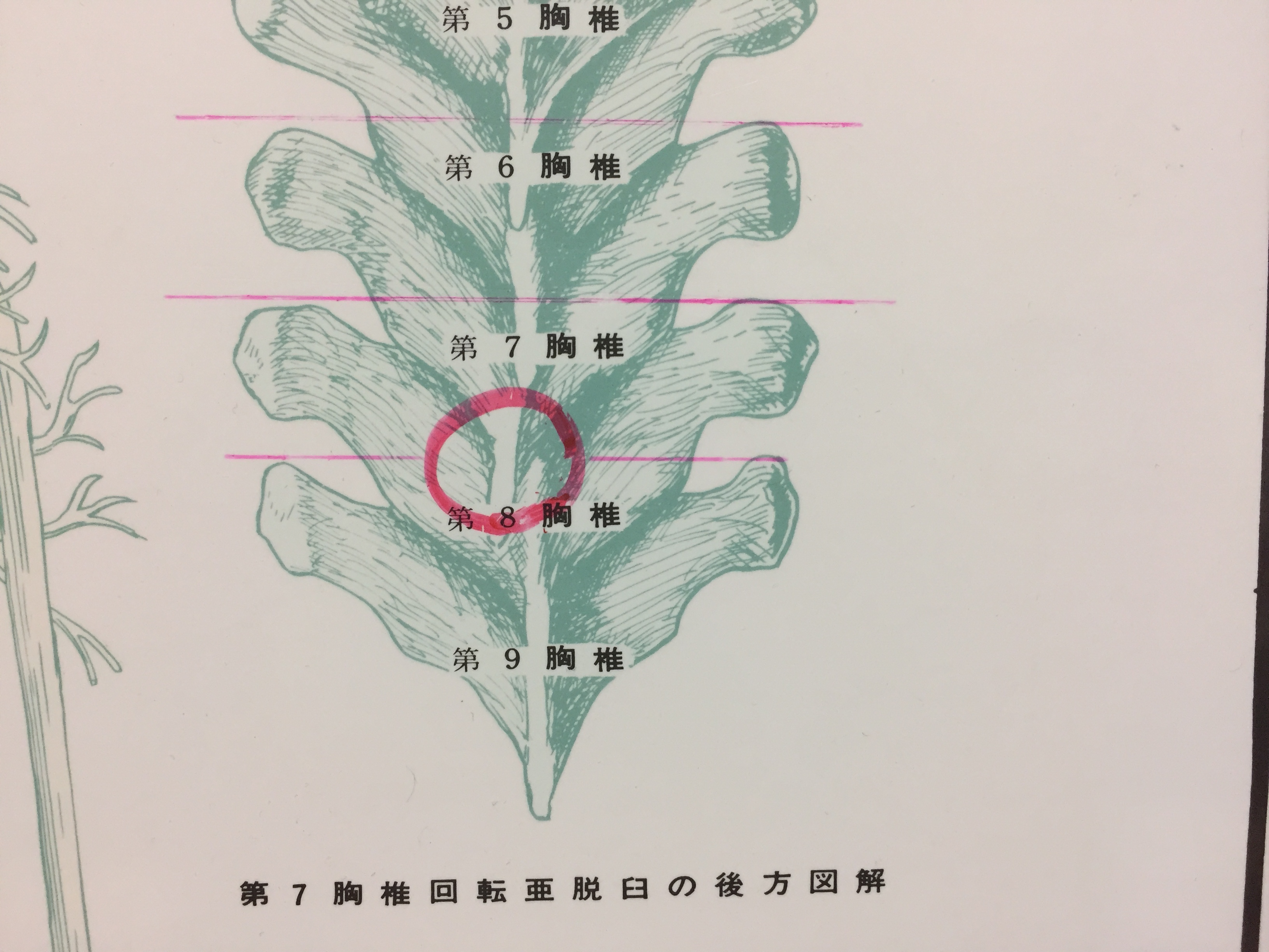 8胸椎.jpg
